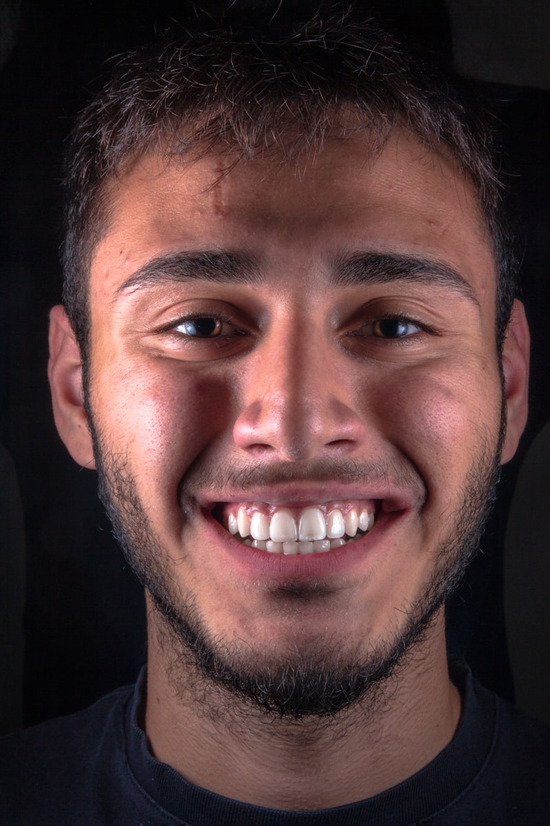 Dentis Implant Hangi Ülkenin Markası? Dentis Implant Hangi Ülkenin Markası?